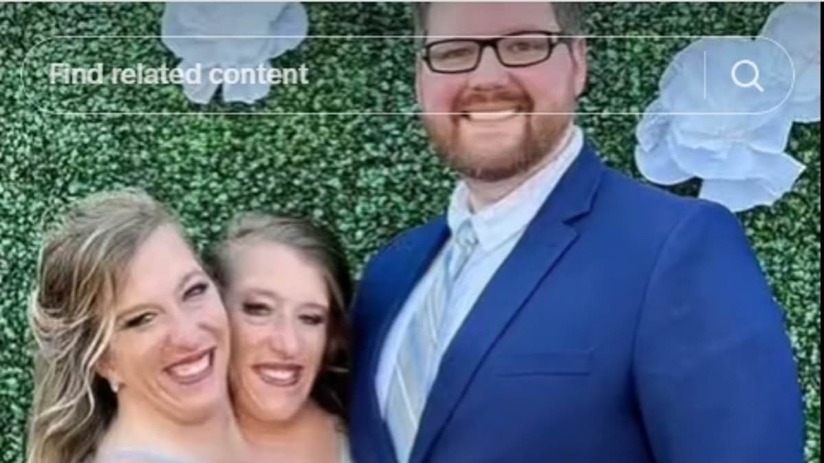 alert-–-conjoined-twins-abby-and-brittany-hensel-break-silence-after-news-of-abby’s-secret-wedding-went-viral-–-as-they-send-cryptic-message-to-‘all-the-haters’