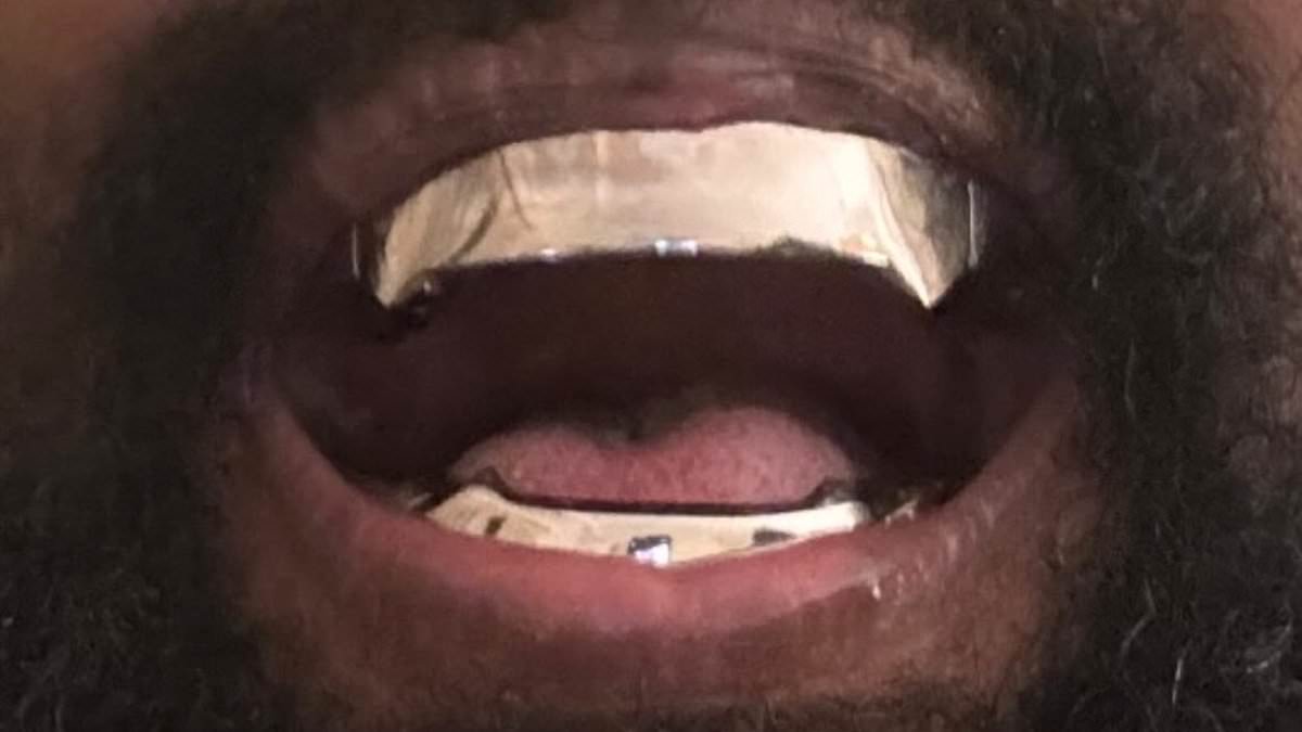 alert-–-as-kanye-west-reveals-he-had-his-teeth-removed-and-replaced-with-james-bond-villain-titanium-dentures…-these-are-some-of-the-celebs-who-also-sported-outrageous-grills