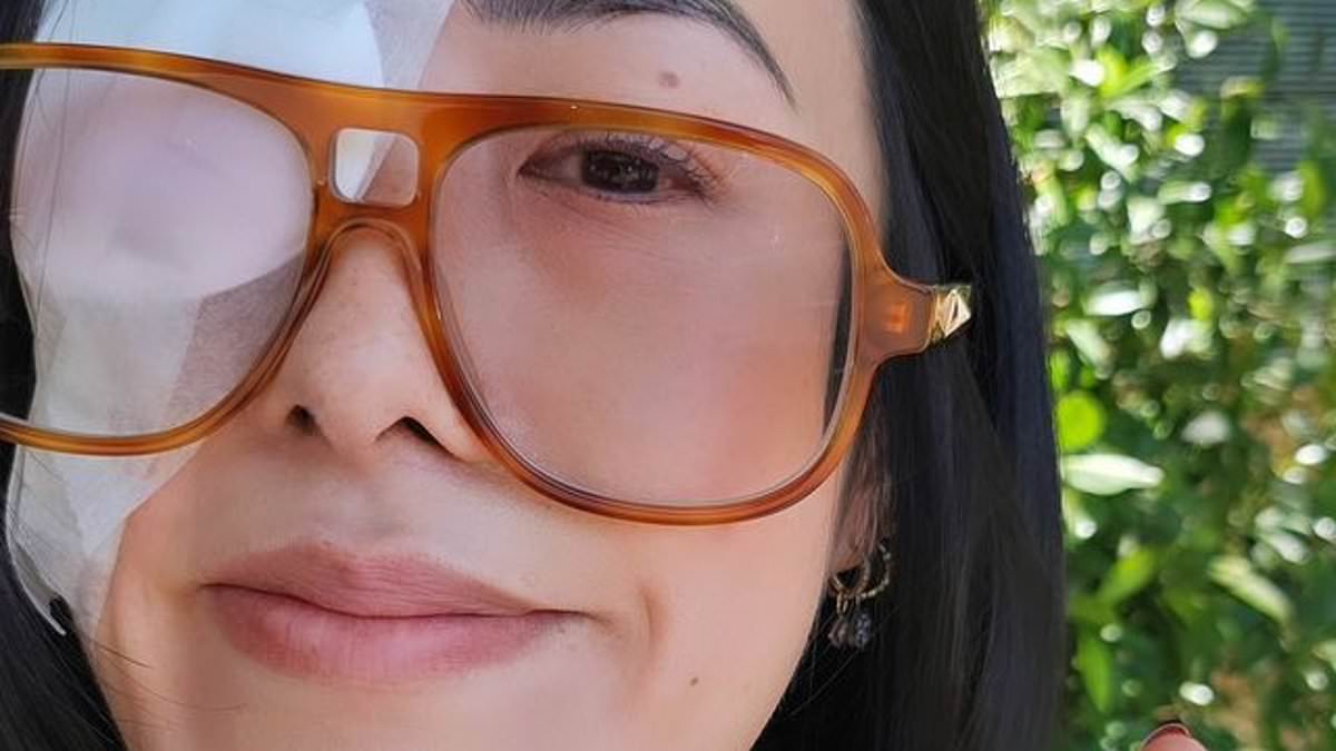 alert-–-melissa-leong-shares-confronting-photos-of-her-bandaged-eye-after-emergency-surgery
