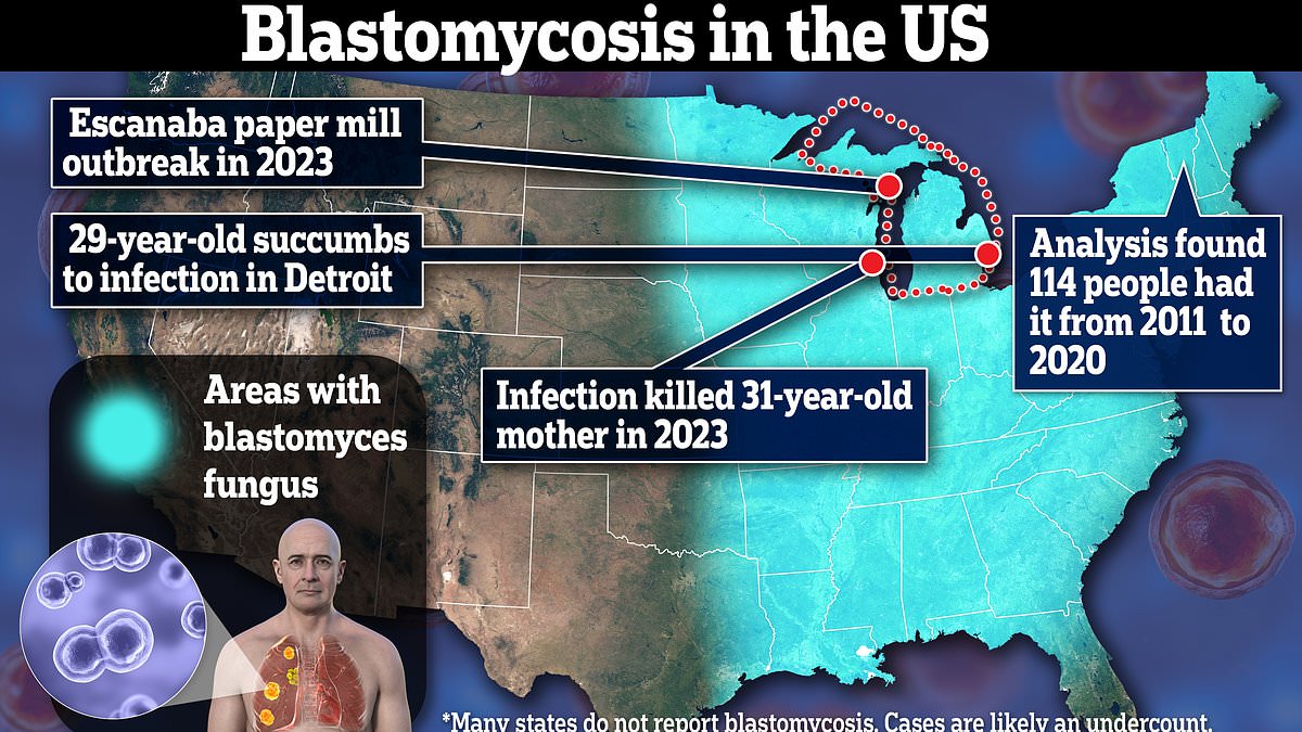 alert-–-frightening-maps-show-how-deadly-fungal-diseases-are-surging-across-the-us-–-as-michigan-woman-reveals-lung-destroying-strain-has-killed-two-of-her-relatives