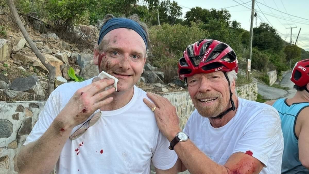 alert-–-richard-branson-in-horror-bike-smash:-daredevil-billionaire-shares-pictures-of-his-injuries-after-flying-off-his-bicycle-after-hitting-pothole-in-virgin-gorda