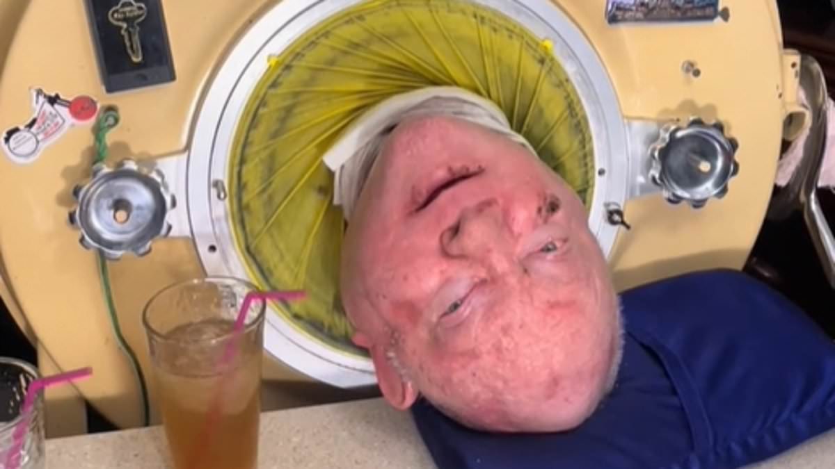 alert-–-iron-lung-man-paul-alexander’s-cause-of-death-is-revealed-after-polio-left-him-paralyzed-and-living-in-metal-casing-for-more-than-70-years