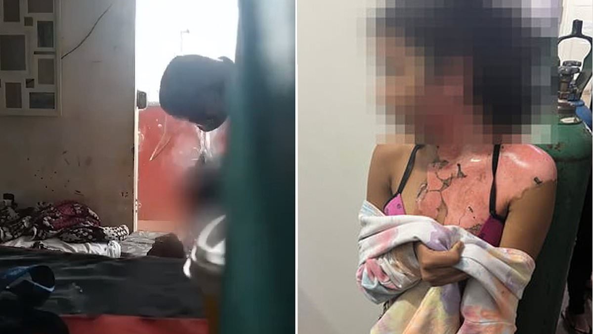 alert-–-horrific-moment-brazilian-woman-flies-into-jealous-rage-and-pours-pot-of-boiling-water-over-her-14-year-old-niece-after-accusing-teen-of-having-sex-with-her-husband