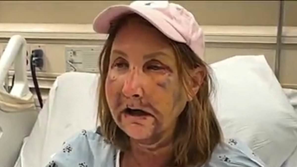 alert-–-la-woman,-54,-suffers-horrific-injuries-including-fractured-jaw-and-lost-teeth-after-being-beaten-by-‘homeless-sex-attacker’-29,’-while-walking-near-her-venice-beach-home