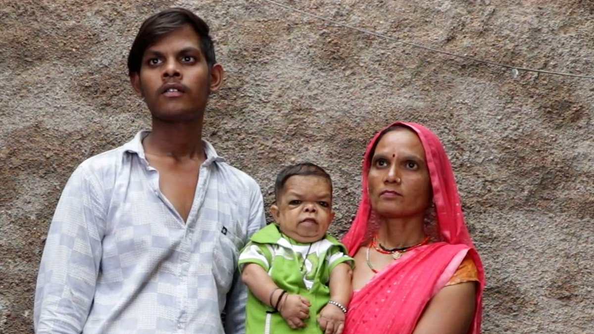 alert-–-i’m-25-and-24ins-tall…-my-mum-has-to-carry-me-everywhere:-the-indian-villager-who-stopped-growing-aged-five-due-to-rare-condition