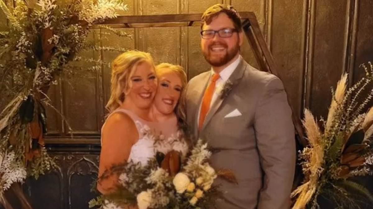 alert-–-conjoined-twins-abby-and-brittany-hensel-share-never-before-seen-photos-from-wedding-to-army-veteran