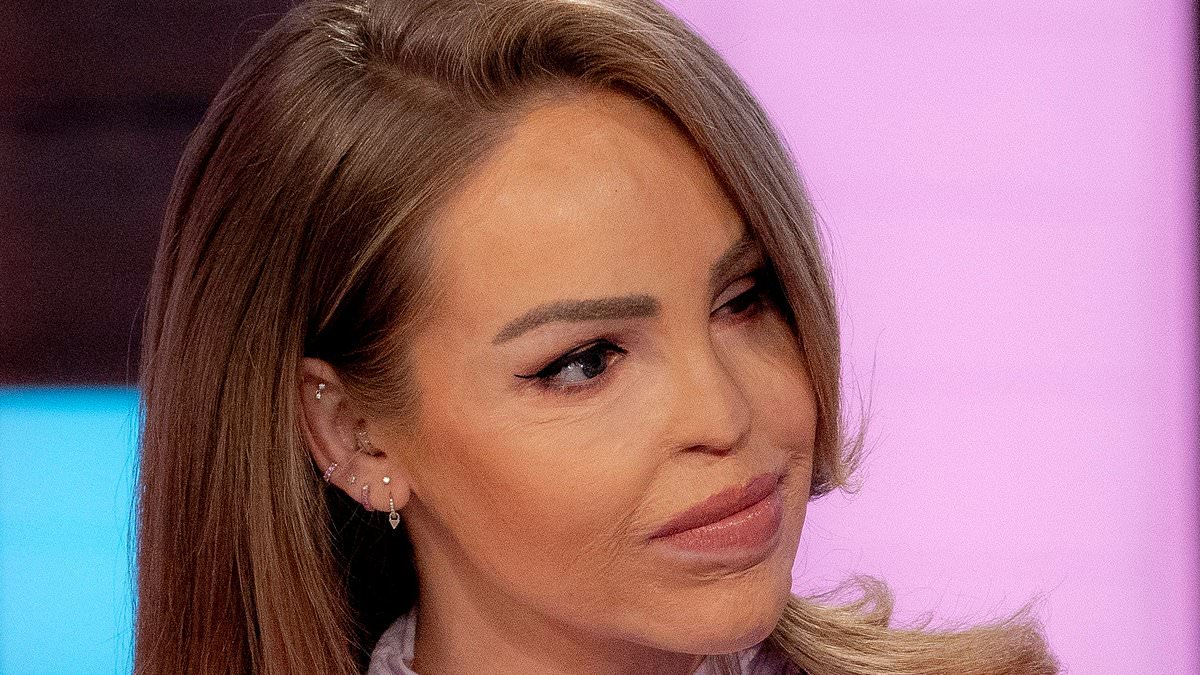 alert-–-katie-piper-reveals-she’s-been-forced-to-pull-out-of-her-itv-breakfast-show-after-undergoing-an-‘unexpected-medical-procedure’