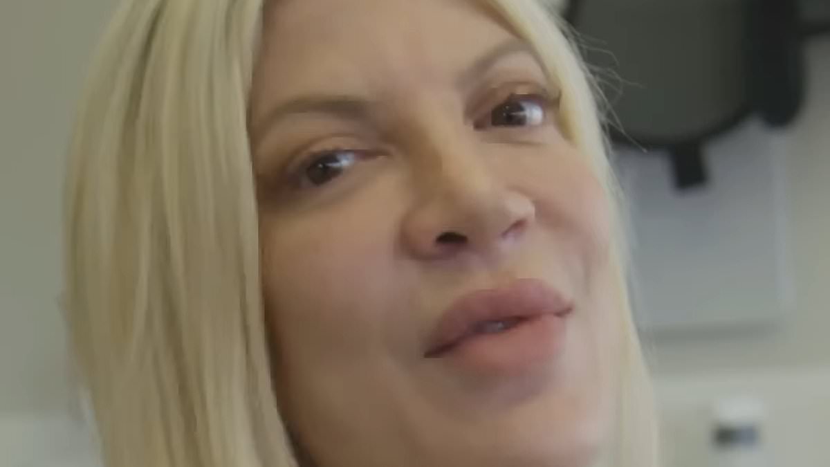 alert-–-tori-spelling-gives-fans-an-inside-look-into-her-veneer-procedure-–-and-reveals-how-her-new-teeth-have-raised-her-confidence:-‘i’m-smiling-again’