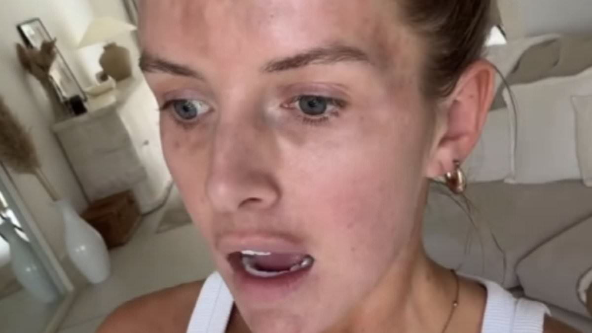 alert-–-love-island’s-faye-winter-bravely-opens-up-on-her-secret-skin-battle-in-makeup-free-video-and-admits-she-felt-‘too-embarrassed’-and-‘scared-about-backlash’-to-reveal-her-bare-face