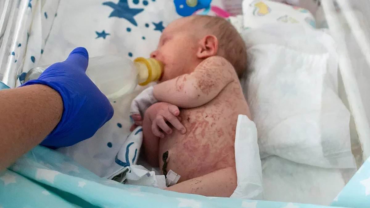 alert-–-newborn-girl-is-found-covered-in-agonising-bites-and-severe-sunburn-after-being-abandoned-on-an-ant-hill-by-her-mother-who-now-faces-attempted-murder-charge-in-russia