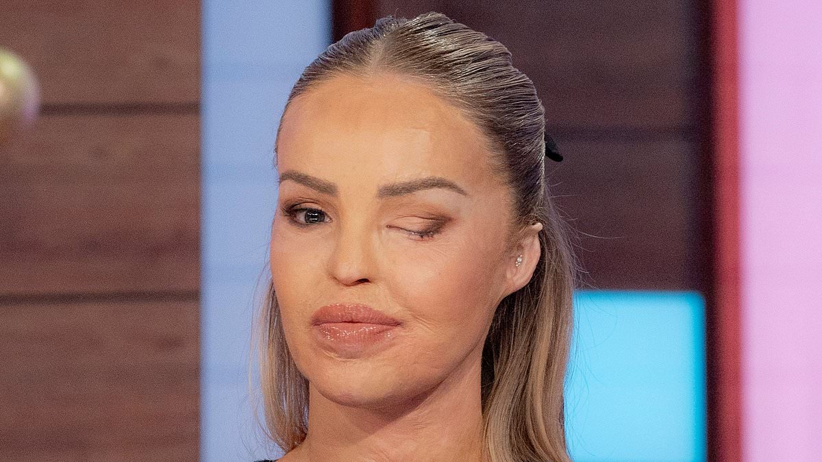 alert-–-agony-for-katie-piper-after-being-told-the-parole-hearing-for-the-stalker-who-ordered-a-devastating-acid-attack-on-her-has-been-delayed