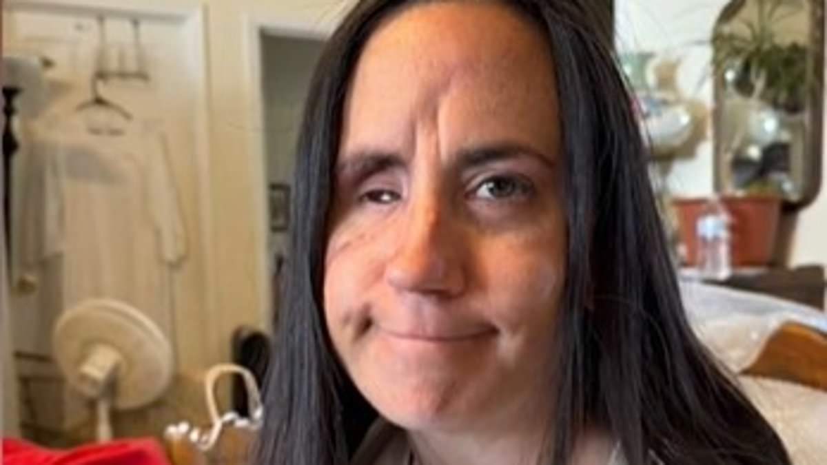 alert-–-arizona-woman-is-left-disfigured-after-burglar-broke-in-and-shot-her-in-eye-while-she-slept-–-as-she-reveals-appalling-reason-health-insurance-won’t-pay-to-fix-her-face