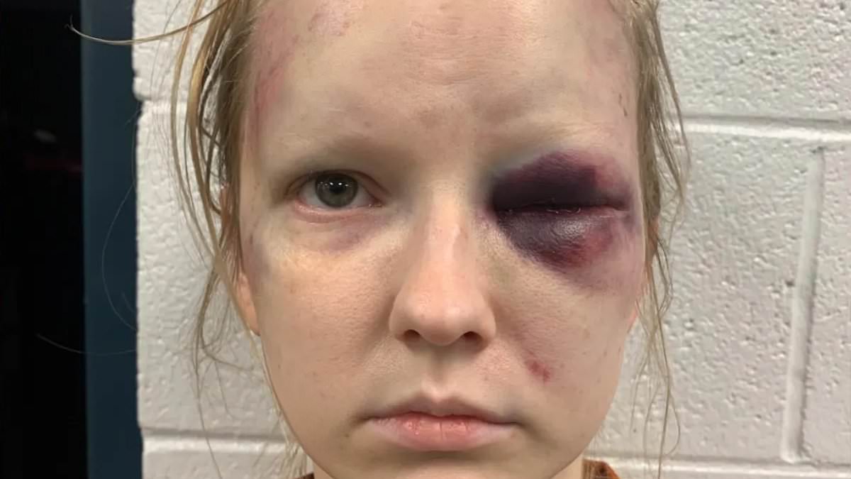 alert-–-the-sinister-story-behind-arkansas-mother’s-bruised-and-beaten-mugshot