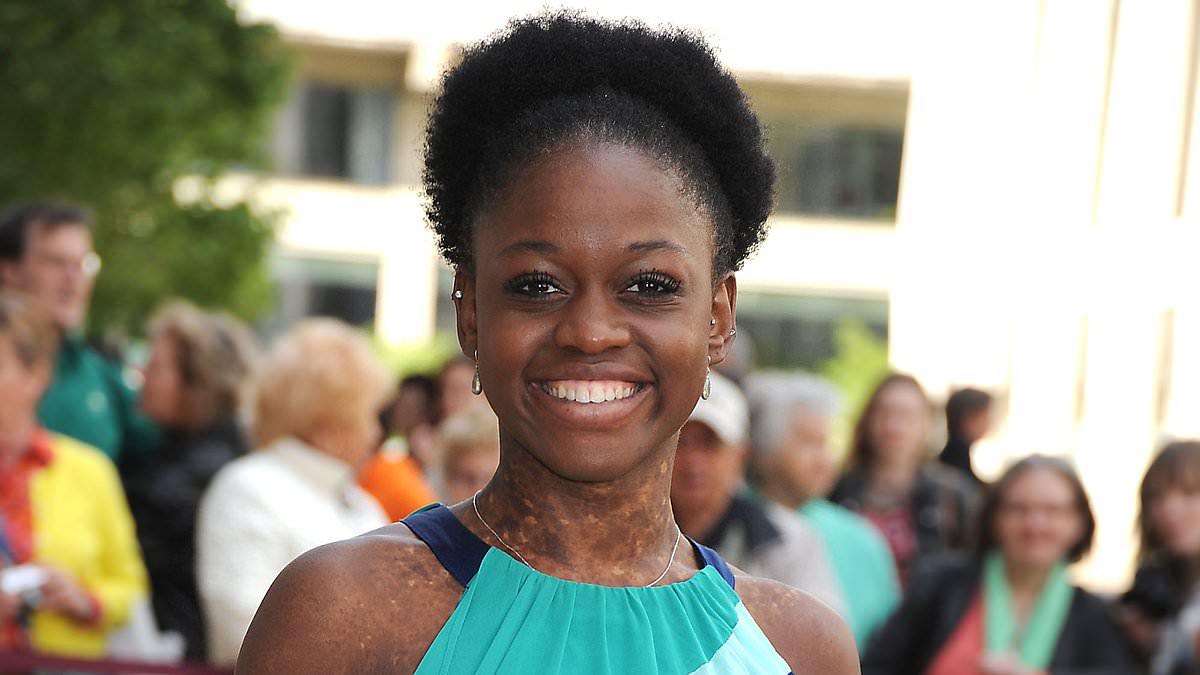 alert-–-trailblazing-ballerina-michaela-deprince-dies-suddenly-aged-29