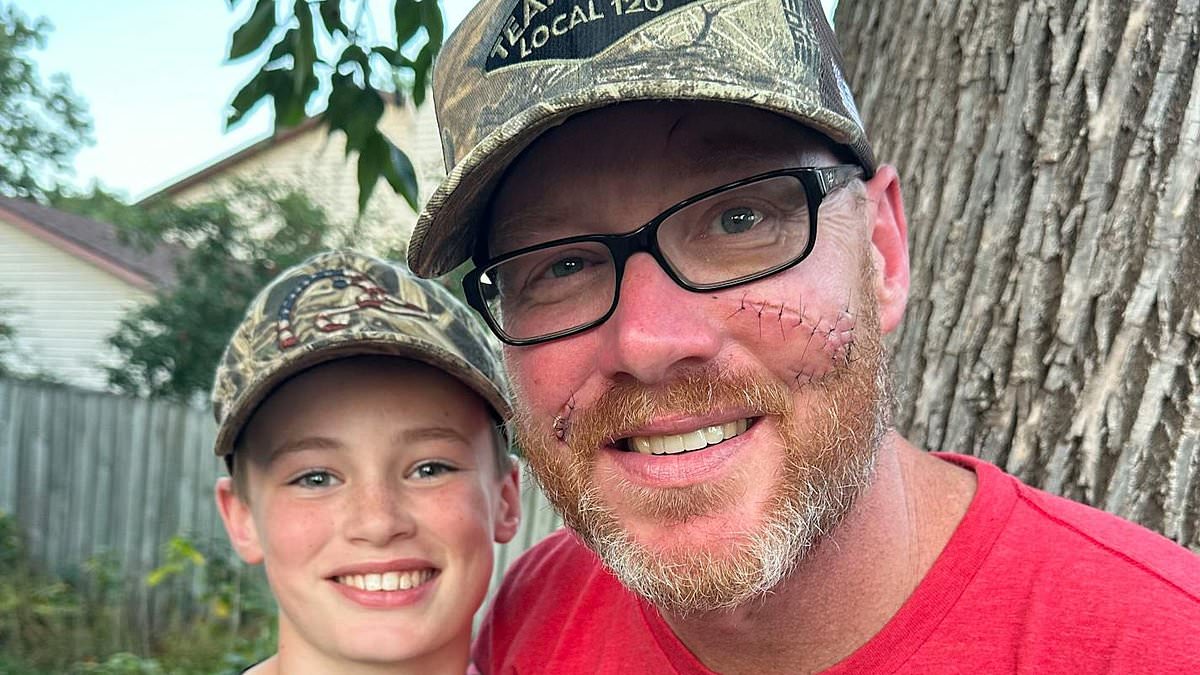 alert-–-gun-toting-12-year-old-boy-saves-his-father-from-bear-attack-as-victim-reveals-the-moment-the-beast’s-fangs-dug-into-his-forehead