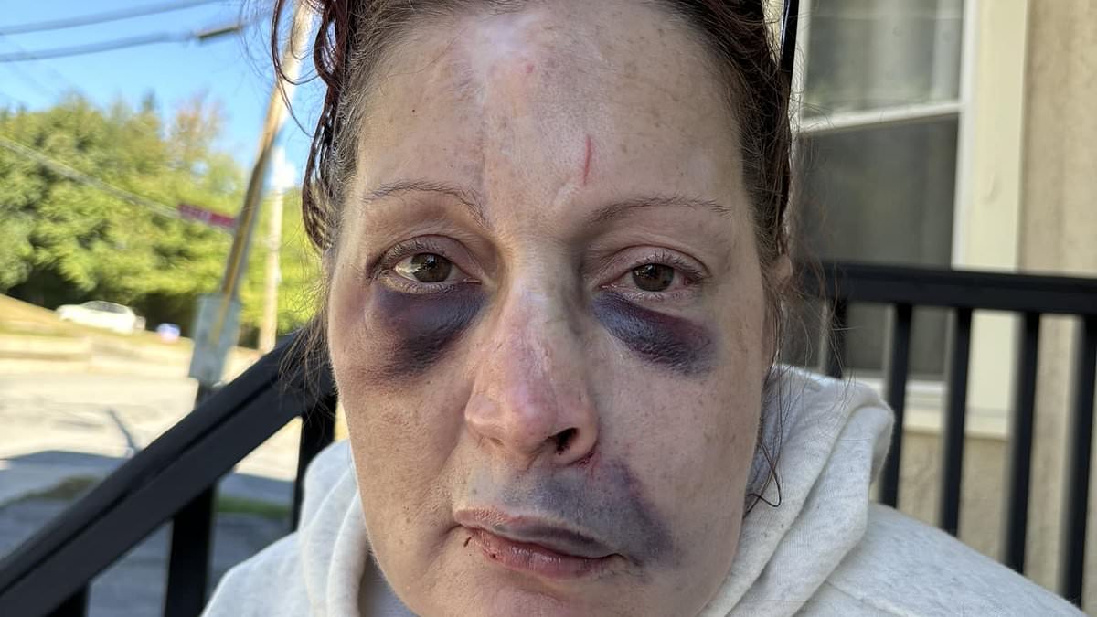 alert-–-woman-who-was-left-bruised-and-bloodied-after-being-beaten-up-by-home-invaders-reveals-how-loyal-pup-saved-her-life