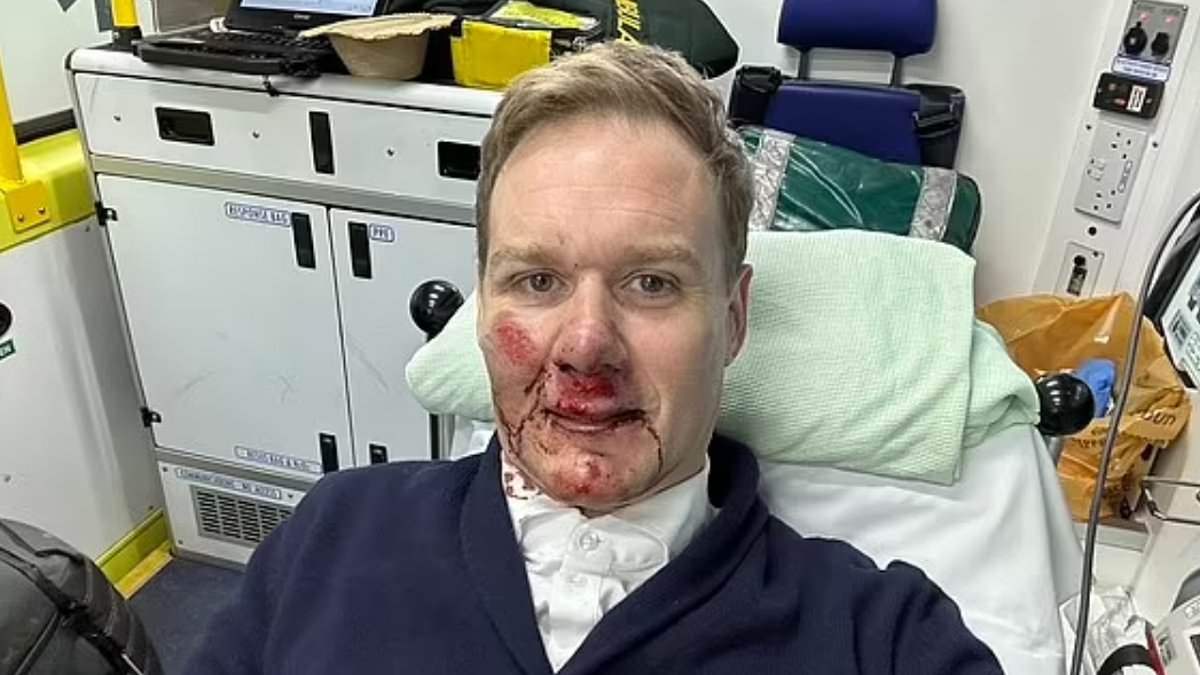 alert-–-dan-walker-reveals-he-doesn’t-remember-his near-fatal-bike-accident-as-he-gears-up-for-200-mile-charity-cycle:-‘i-was-out-cold-for-a-bit’