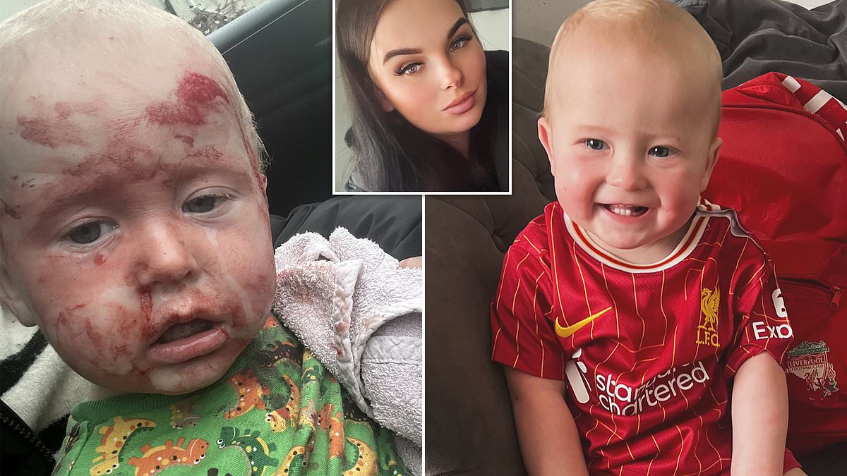 alert-–-mother-claims-her-toddler-nearly-died-when-their-washing-machine-exploded,-leaving-him-dripping-in-blood-with-‘a-chunk-of-his-finger-hanging-off’