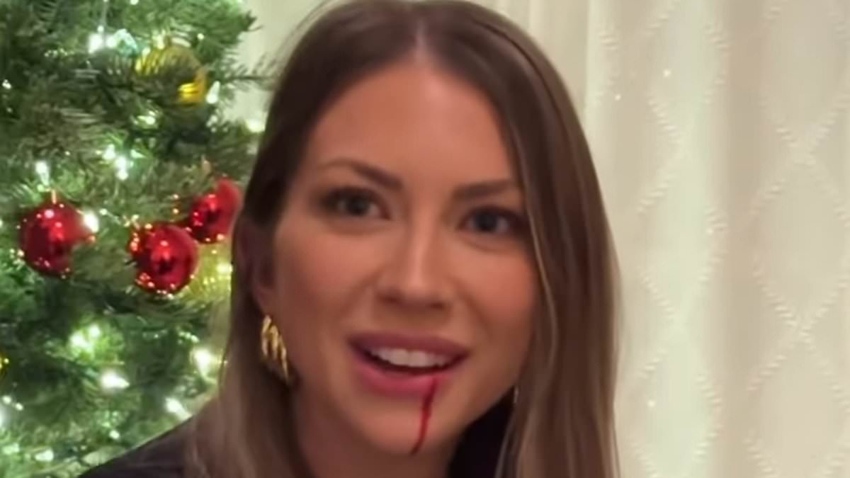 alert-–-stassi-schroeder-left-bleeding-after-daughter-hartford,-three,-cut-her-face-with-toy-broom