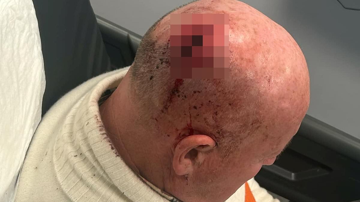 alert-–-liverpool-supporter-left-inches-from-death-after-brutal-‘attack’-outside-anfield-by-rival-fan-leaves-him-with-blood-pouring-from-his-head