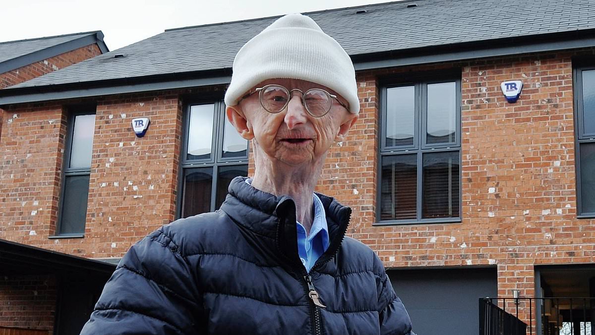 alert-–-disabled-pensioner-alan-barnes-who-stands-just-4ft-6ins-tall-tells-how-being-attacked-by-drug-addict-outside-his-home-10-years-ago-‘changed-my-life’