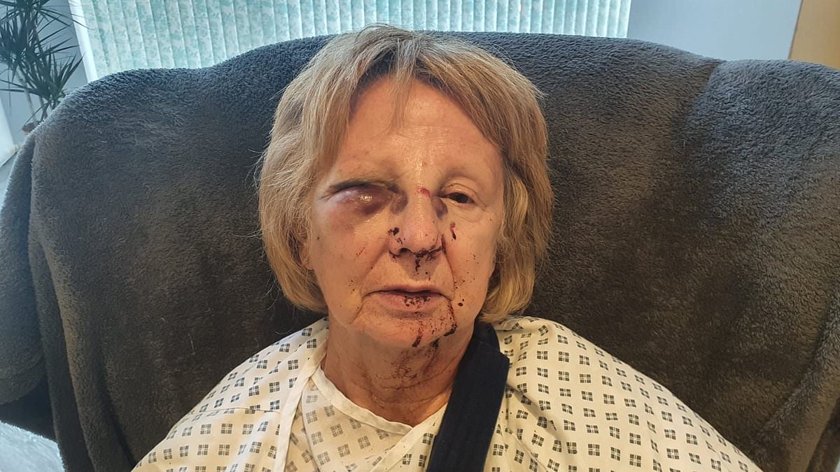 alert-–-thug-accused-pensioner,-71,-of-‘histrionics’-after-breaking-her-eye-socket,-ribs-and-collar-bone-in-attack-following-row-over-garden-fence