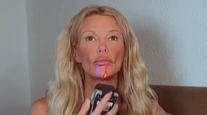 alert-–-brandi-glanville,-52,-shows-off-her-changing-face-as-she-tries-out-beauty-treatment-amid-her-disfiguring-skin-condition-woes