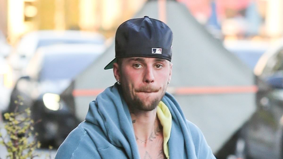 alert-–-justin-bieber-sparks-major-concern-with-disheveled-appearance-after-another-spa-visit-in-la