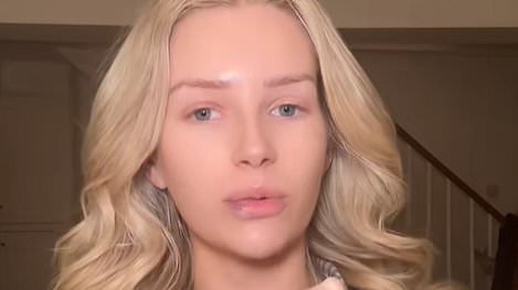alert-–-lottie-moss-reveals-her-‘new-face’ in-emotional-update-after-having-‘awful’-jaw-and-lip-filler-dissolved-as-she-admits:-‘i-feel-like-me-again-after-being-in-a-dark-place’