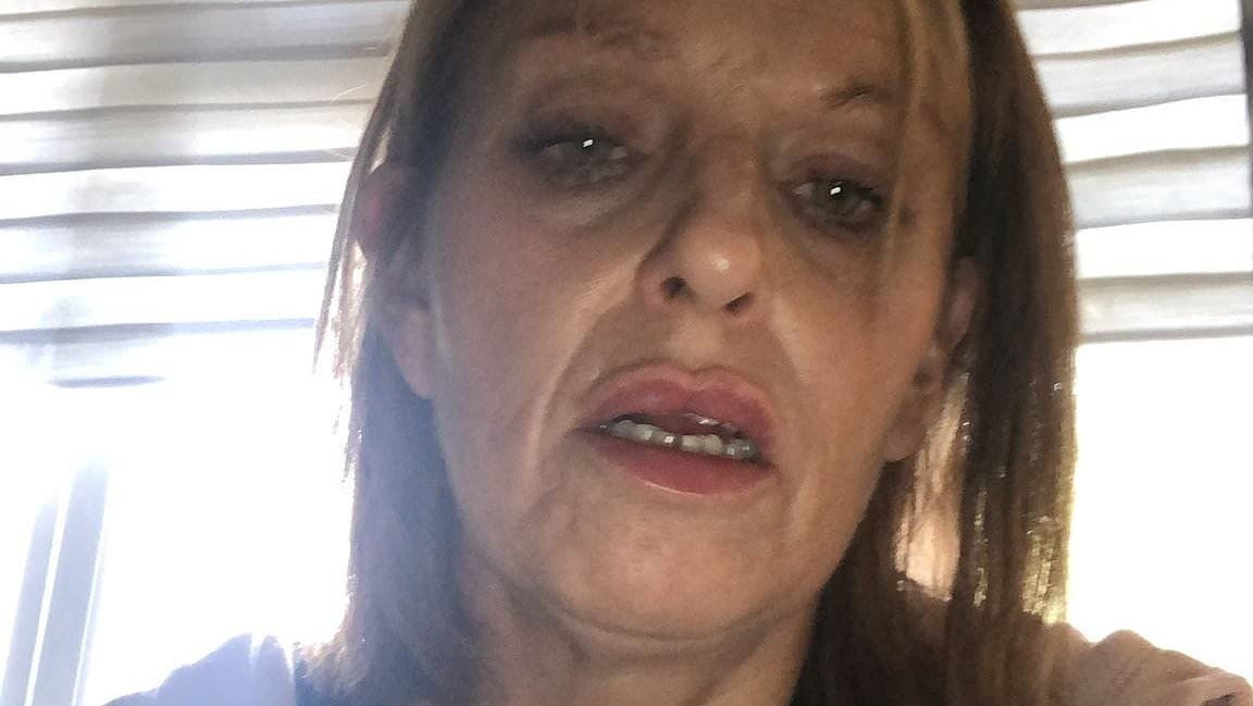 alert-–-shocking-photos-show-mother’s-downward-drug-spiral-over-two-decades:-from-trying-pills-and-acid-for-the-first-time-to-a-900-a-day-heroin-addiction