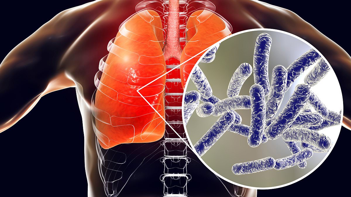 alert-–-aussie-dies-after-being-infected-with-dangerous-disease-–-as-new-cases-continue-to-emerge-after-major-outbreak-in-sydney’s-cbd