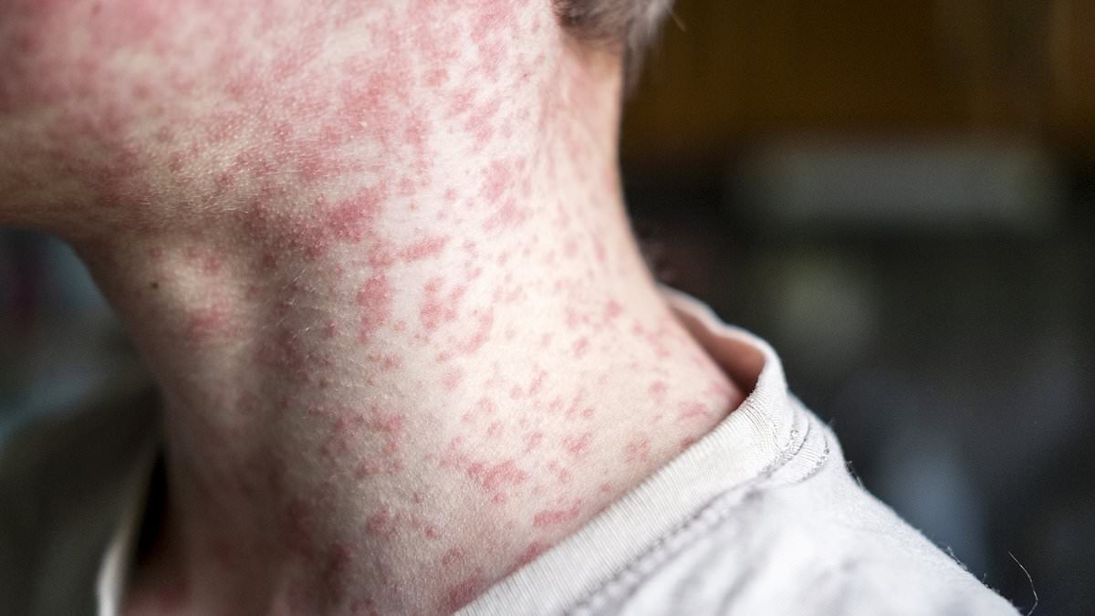 alert-–-major-outbreak-fears-as-world’s-most-contagious-disease-hits-baseball-game-attended-by-40,000