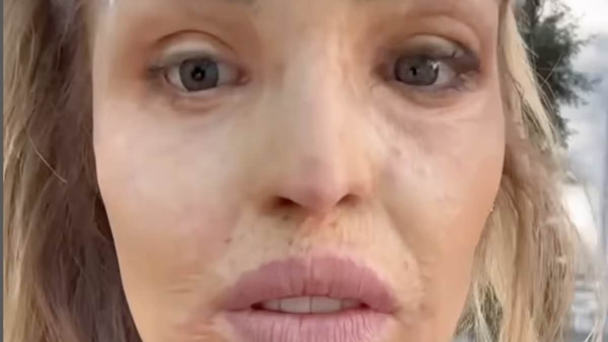 alert-–-katie-piper-shows-off-her-new-glass-eye-in-remarkable-before-and-after-shots-after-travelling-to-hamburg-for-pioneering-treatment