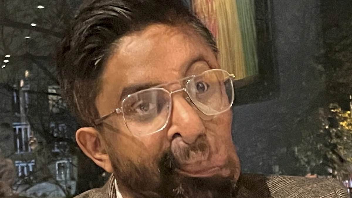 alert-–-man-claims cafe-refused-to-serve-him-and-looked-like-they’d-‘seen-a-ghost’-because-of-his-facial-tumours