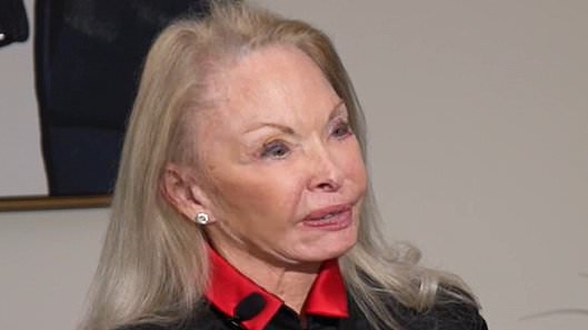 alert-–-distraught-women-show-what-plastic-surgeon-did-to-their-faces-after-they-asked-to-be-‘refreshed’