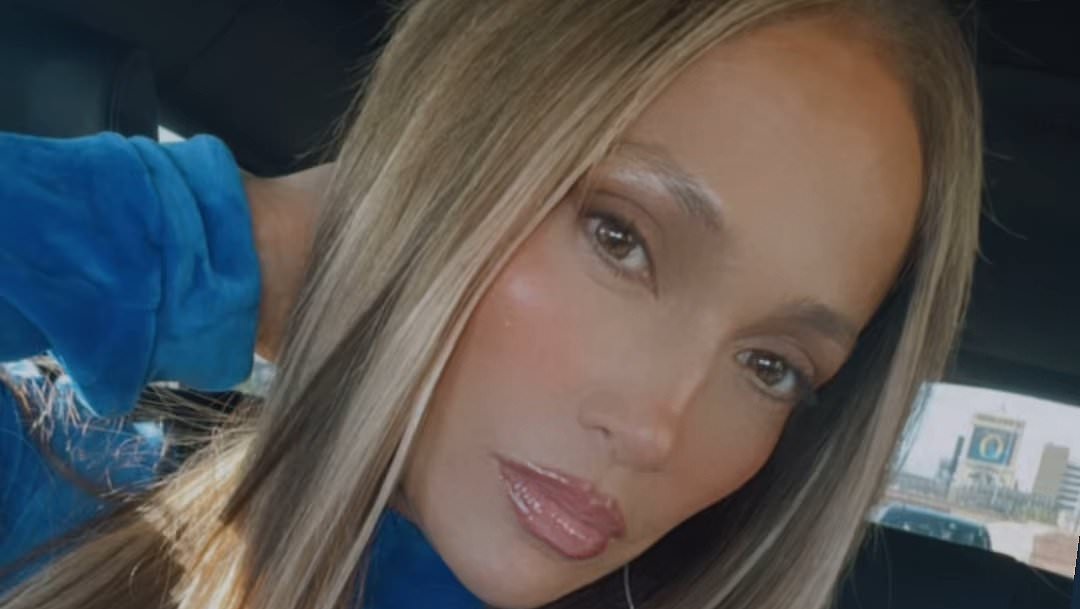 alert-–-jennifer-lopez’s-heavily-filtered-selfie-sparks-concern-after-nose-injury