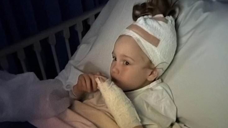 alert-–-parents’-horror-as-their-six-year-old-girl-is-mauled-by-an-american-staffy-in-a-public-park-and-almost-scalped