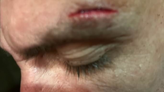alert-–-british-father-of-two-claims-he-was-‘beaten-up-twice-inside-hotel’-during-‘nightmare’-turkish-holiday
