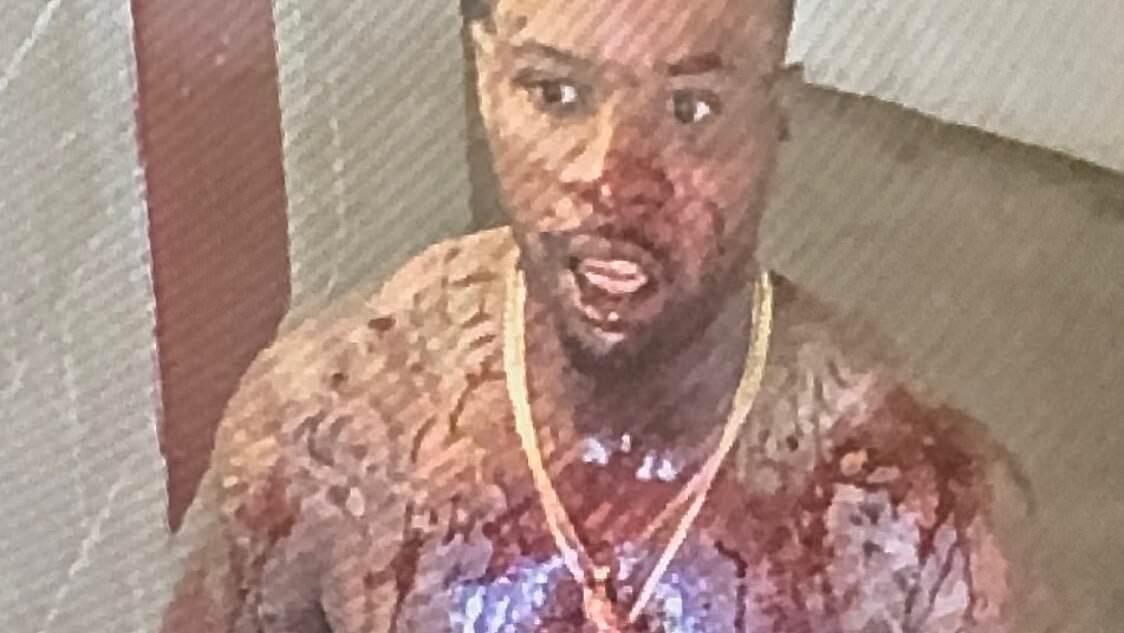alert-–-shocking-pictures-show-tory-lanez-covered-in-blood-after-being-stabbed-14-times-inside-california-prison-where-he-is-serving-ten-years-for-shooting-megan-thee-stallion