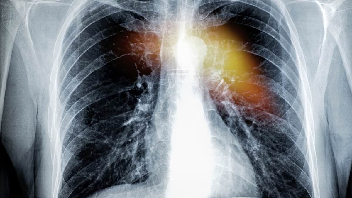 alert-–-huge-heart-attack-risk-linked-to-dirty-habit-that-thousands-of-australians-are-doing-daily
