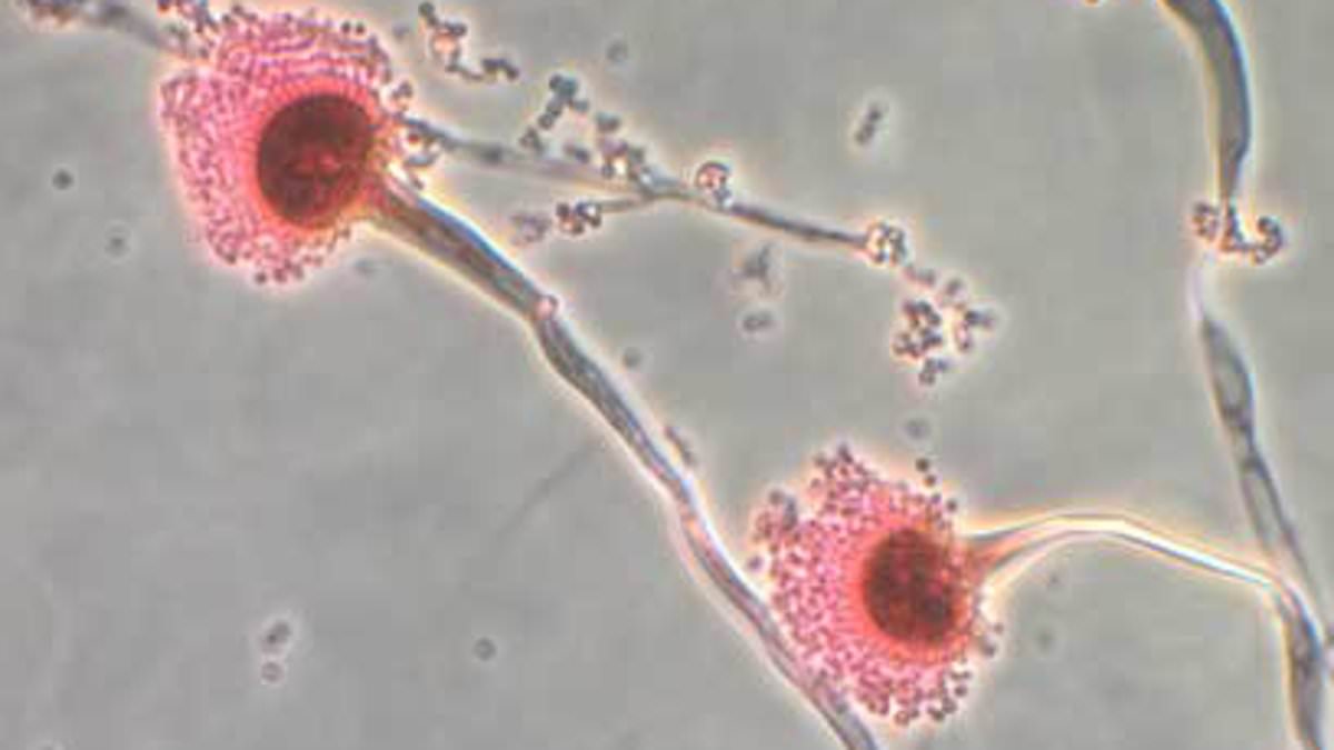 alert-–-deadly-fungus-that-‘eats-you-from-the-inside-out’-invades-us:-‘hundreds-of-thousands-of-lives-at-risk’