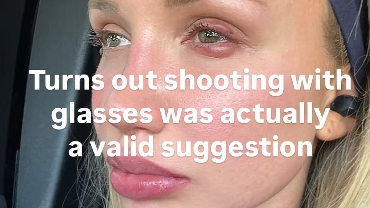 alert-–-australian-model-reveals-gruesome-injury-from-‘shooting’-accident
