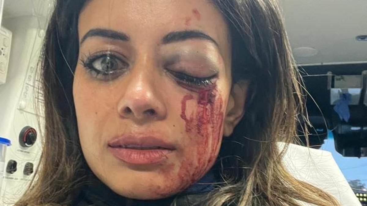 alert-–-shocking-photo-emerges-of-former-greens-candidate-who-faces-losing-her-sight-after-being-injured-during-a-violent-arrest-at-an-anti-israel-protest