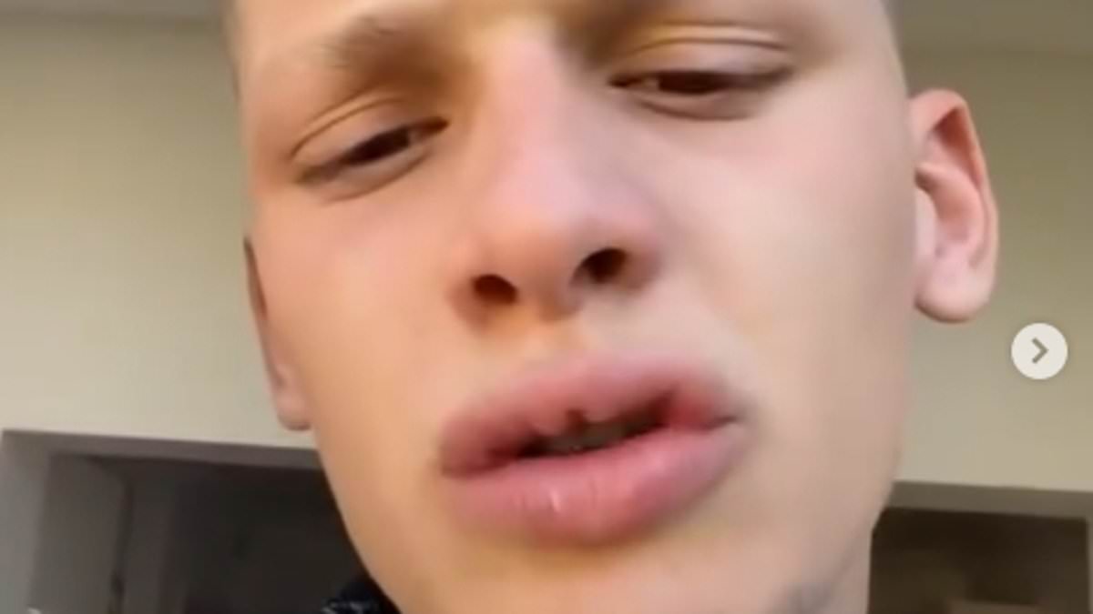 alert-–-freddy-brazier,-20,-reveals-he-missed-flight-to-ibiza-after-getting-punched-and-handed-a-fine-on-his-way-to-the-airport-for-impromptu-trip-–-following-u-turn-on-rehab-decision