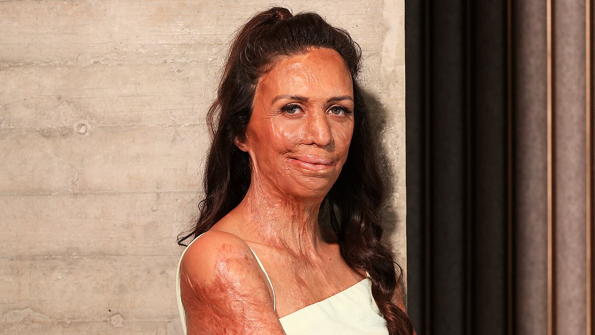alert-–-inspirational-burns-survivor-turia-pitt-reveals-new-career-move-after-being-forced-to-change-her-life-as-she-was-‘pushing-her-own-needs-aside’