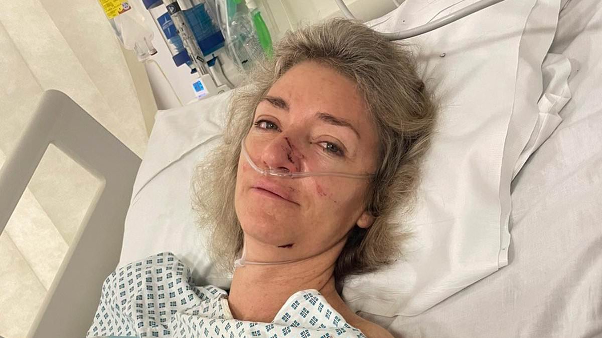alert-–-i-was-run-over-by-two-tube-trains-and-had-two-limbs-amputated-after-slipping-off-wet-platform-–-i-can-never-hug-my-children-with-both-arms-again-and-tfl-say-it’s-my-fault