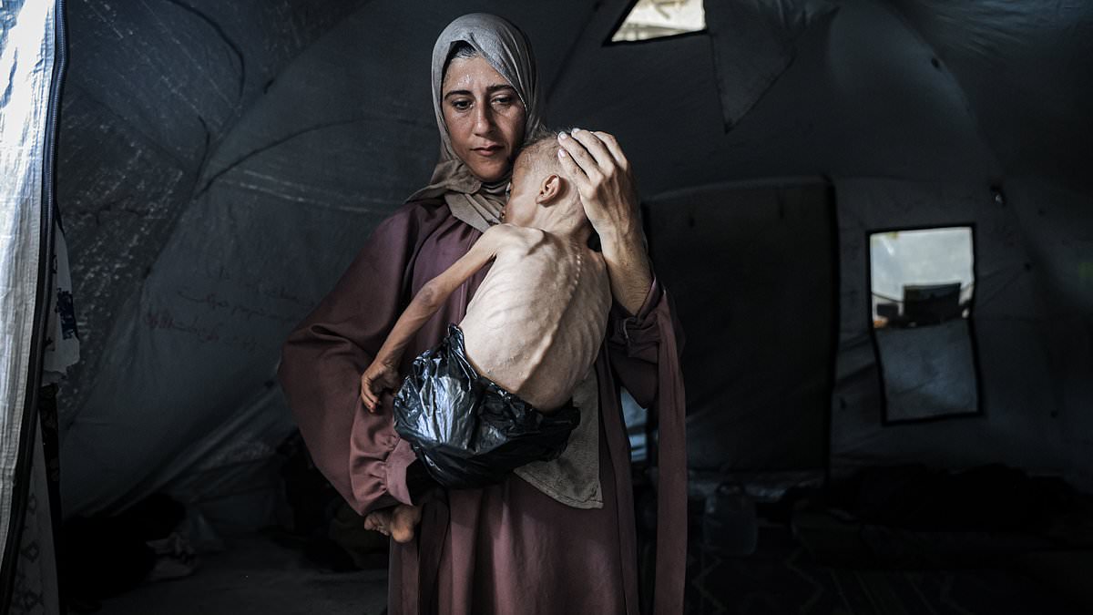 alert-–-reduced-to-skin-and-bones-in-gaza:-horrifying-story-behind-photo-of-starving-child-with-a-plastic-bag-as-a-nappy