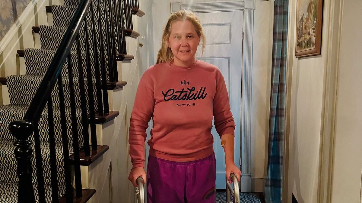 alert-–-amy-schumer-shocks-fans-posing-with-walker-as-she-reveals-secret-spinal-surgery-after-surfing-accident