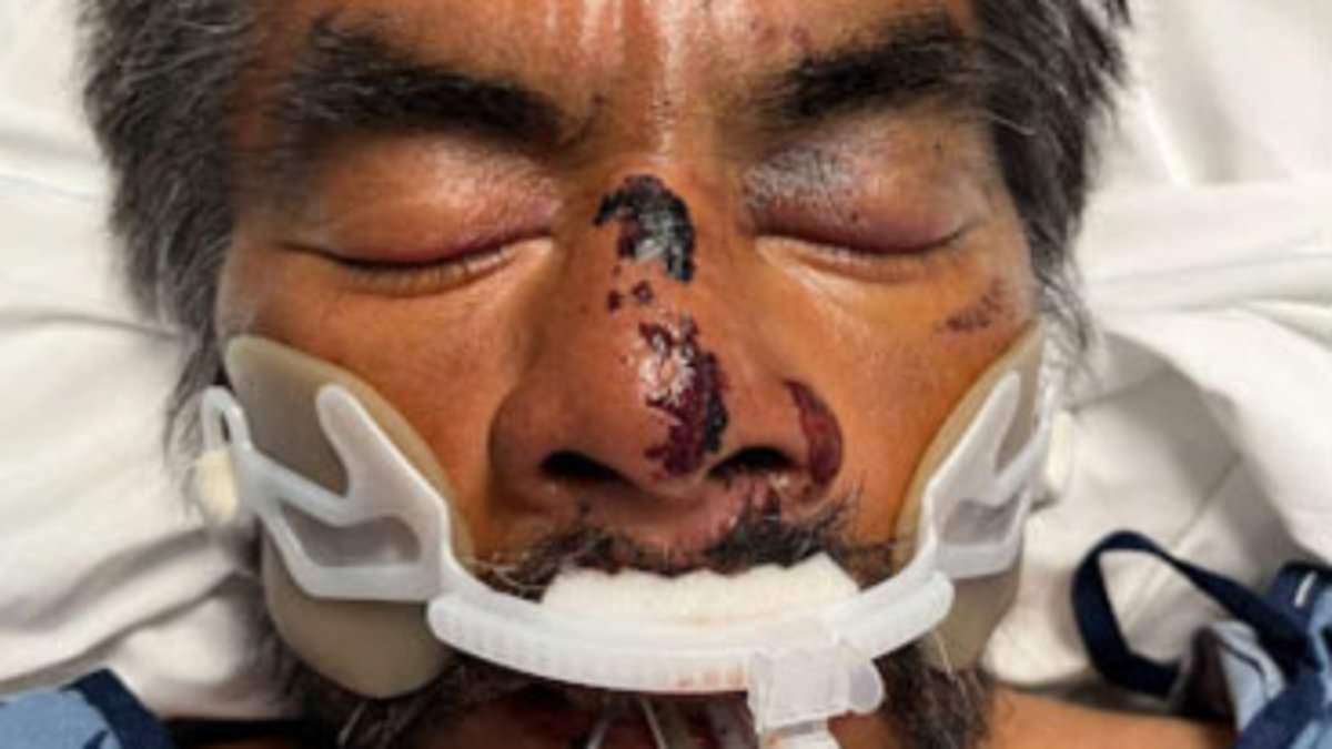 alert-–-‘america’s-saddest-man’-beaten-up-and-taken-to-la-hospital…but-no-one-knows-who-he-is