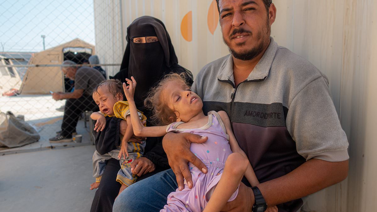 alert-–-british-nurse-in-gaza-shares-reality-of-malnutrition-on-the-frontlines-as-brave-medics-battle-shortages-to-treat-patients